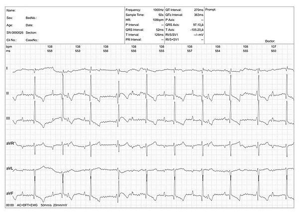 ECG recording used to evaluate cardiac arrhythmias in dogs and cats.